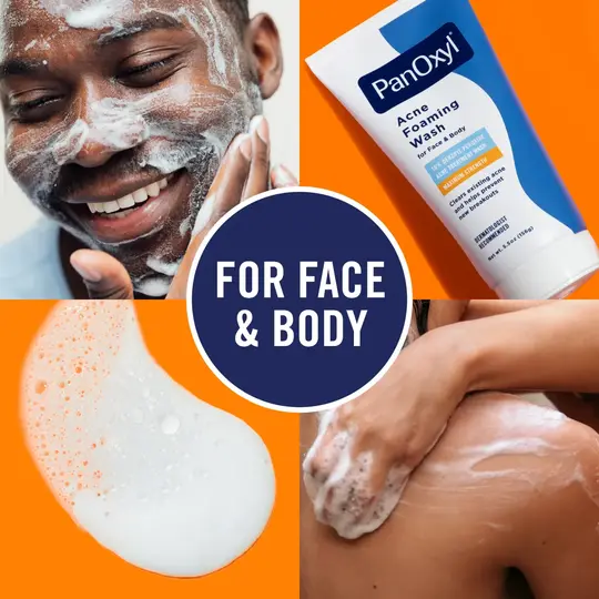 بانوكسيل غسول وجه 10% PANOXYL ACNE WASH